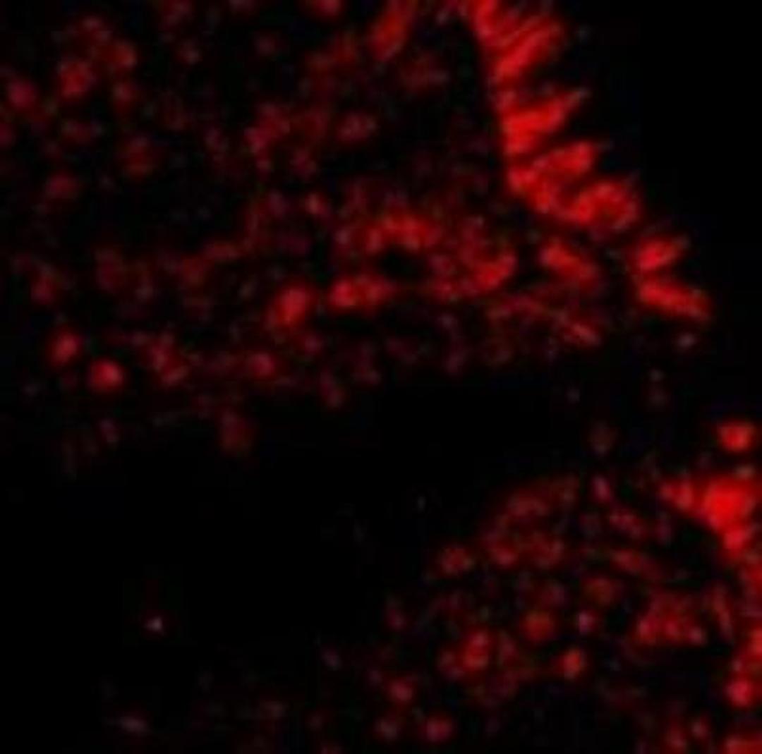 Immunocytochemistry/Immunofluorescence: MICA Antibody [NBP1-76805] - in Human Colon cells with MICA