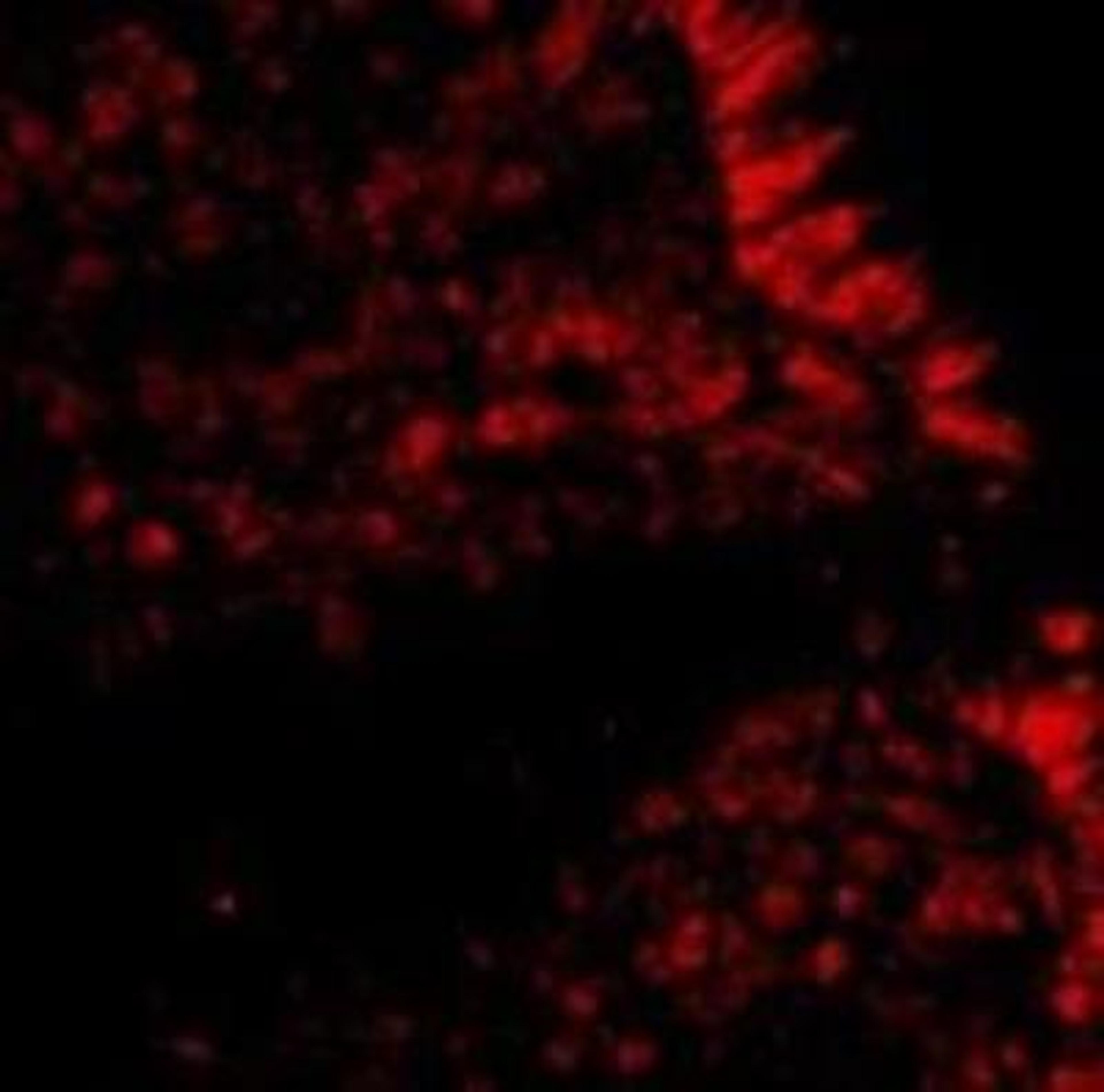 Immunocytochemistry/Immunofluorescence: MICA Antibody [NBP1-76805] - in Human Colon cells with MICA