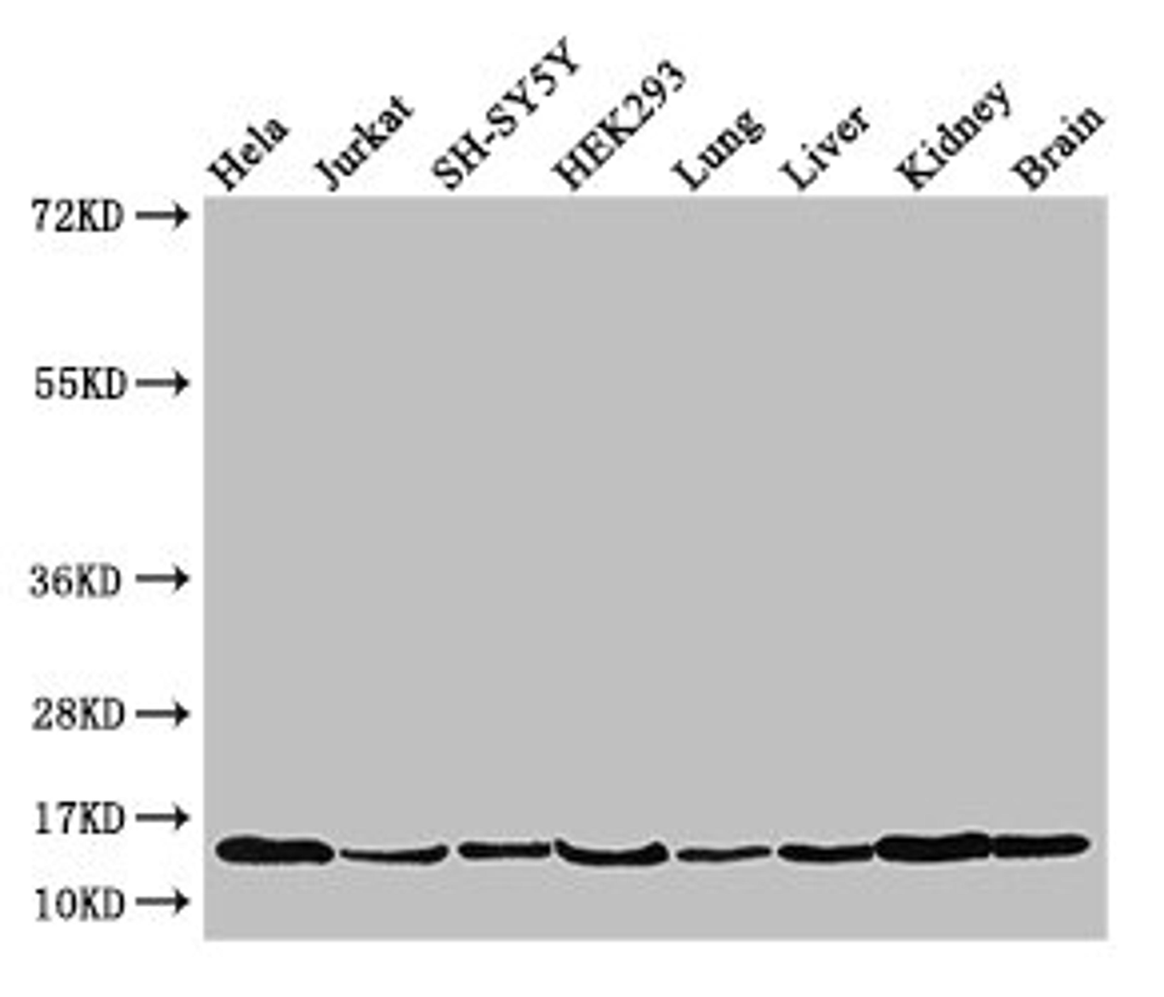 Western Blot. Positive WB detected in: Hela whole cell lysate, Jurkat whole cell lysate, SH-SY5Y whole cell lysate, HEK293 whole cell lysate, Mouse lung tissue, Mouse liver tissue, Mouse kidney tissue, Mouse brain tissue. All lanes: PAIP2 antibody at 3.5µg/ml. Secondary. Goat polyclonal to rabbit IgG at 1/50000 dilution. Predicted band size: 15 kDa. Observed band size: 15 kDa