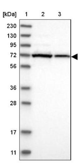 Western Blot: AGPS Antibody [NBP1-89240] - Lane 1: Marker [kDa] 230, 130, 95, 72, 56, 36, 28, 17, 11<br/>Lane 2: Human cell line RT-4<br/>Lane 3: Human cell line U-251MG sp