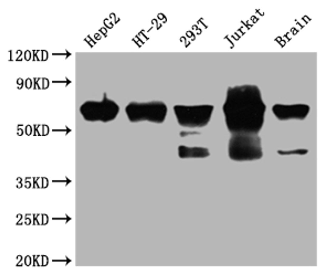 Western Blot. Positive WB detected in: HepG2 whole cell lysate, HT-29 whole cell lysate, 293T whole cell lysate, Jurkat whole cell lysate, Mouse brain tissue. All lanes: DDX5 antibody at 1:2000. Secondary. Goat polyclonal to rabbit IgG at 1/50000 dilution. Predicted band size: 70, 61 kDa. Observed band size: 70 kDa. 