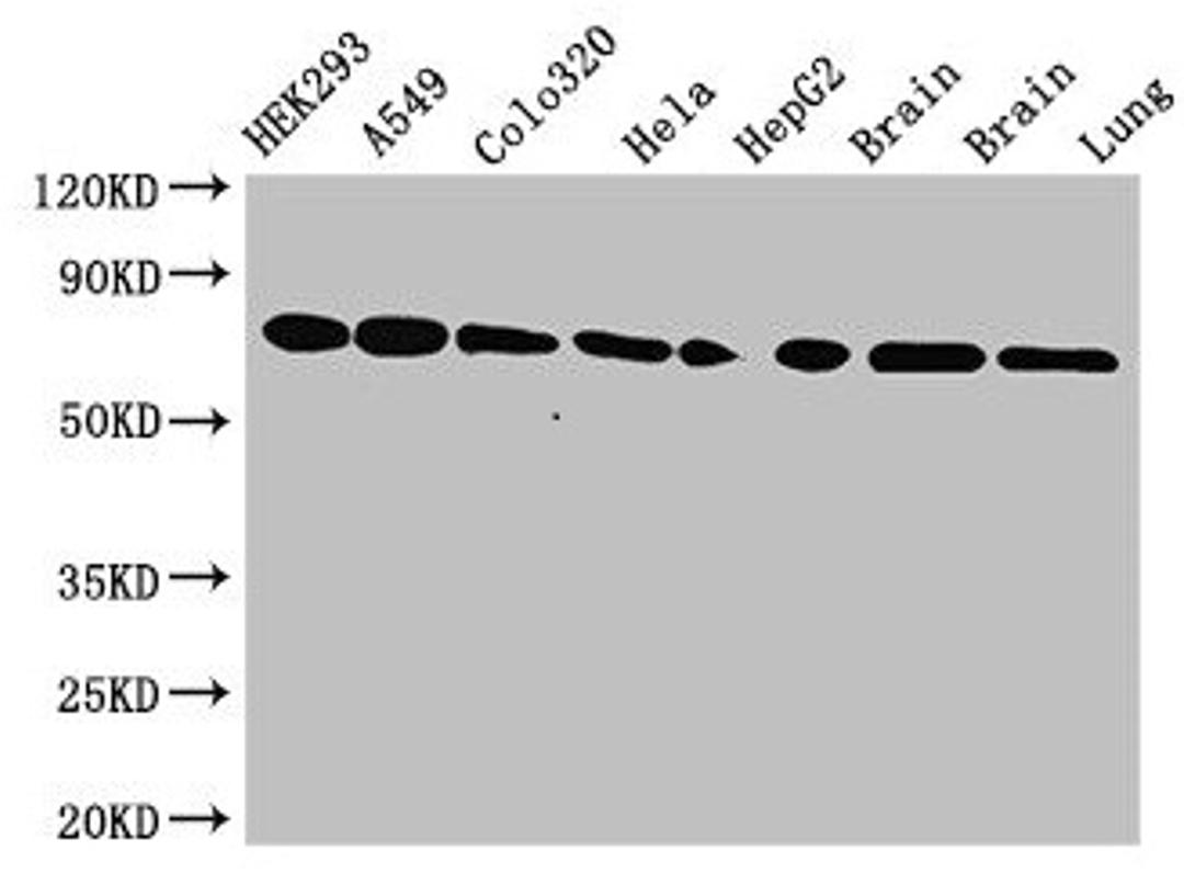 Western Blot. Positive WB detected in: HEK293 whole cell lysate, A549 whole cell lysate, Colo320 whole cell lysate, Hela whole cell lysate, HepG2 whole cell lysate, Mouse brain tissue, Rat brain tissue, Rat lung tissue. All lanes: HSPA8 antibody at 3.5µg/ml. Secondary. Goat polyclonal to rabbit IgG at 1/50000 dilution. Predicted band size: 71, 54 kDa. Observed band size: 71 kDa