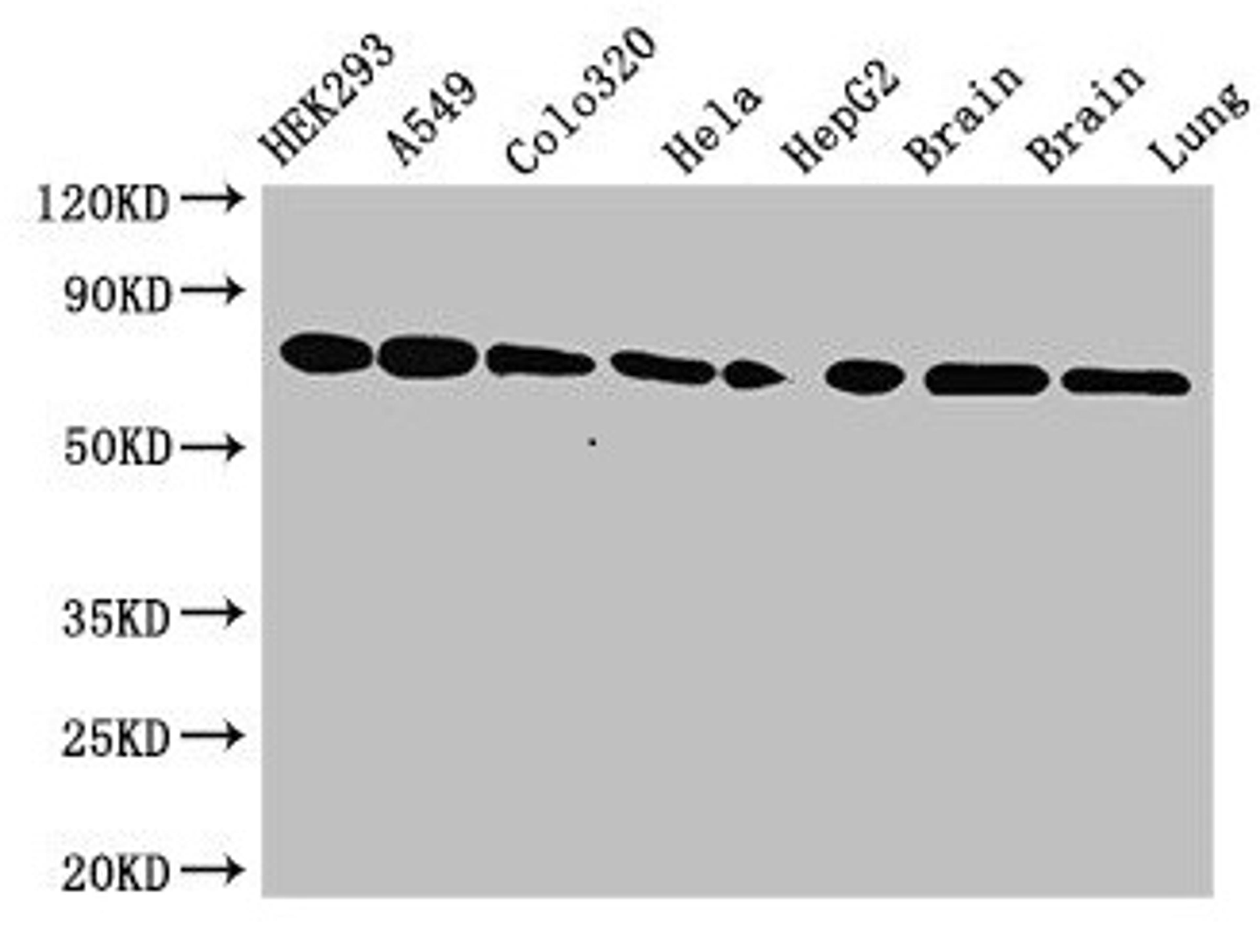 Western Blot. Positive WB detected in: HEK293 whole cell lysate, A549 whole cell lysate, Colo320 whole cell lysate, Hela whole cell lysate, HepG2 whole cell lysate, Mouse brain tissue, Rat brain tissue, Rat lung tissue. All lanes: HSPA8 antibody at 3.5µg/ml. Secondary. Goat polyclonal to rabbit IgG at 1/50000 dilution. Predicted band size: 71, 54 kDa. Observed band size: 71 kDa