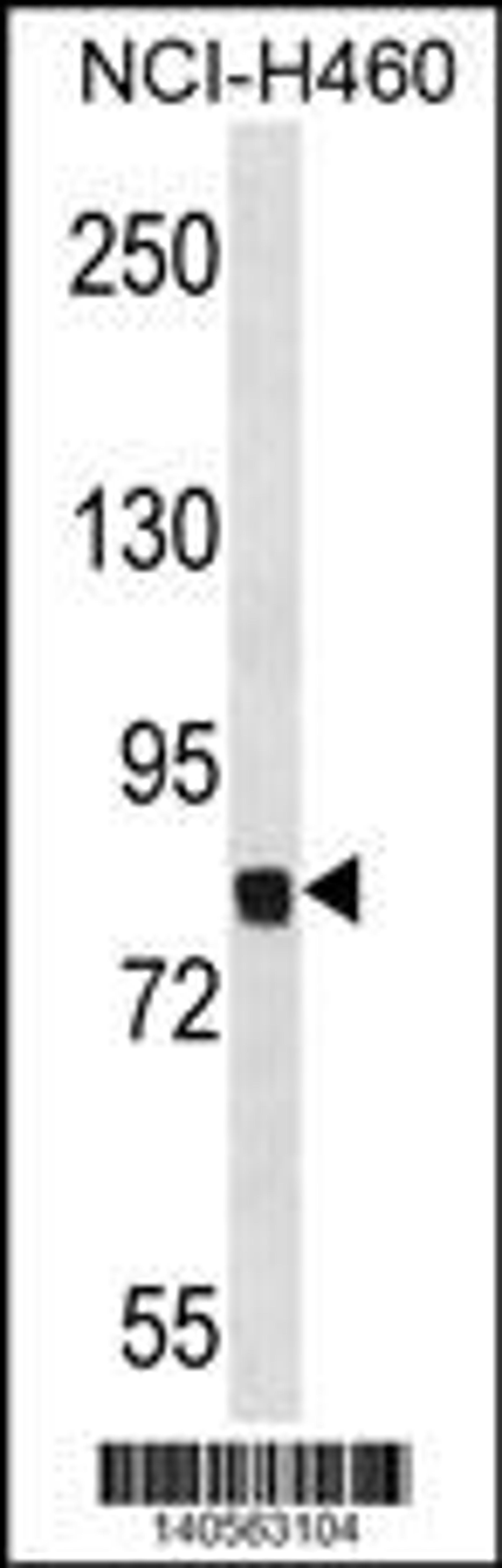 Western blot analysis in NCI-H460 cell line lysates (35ug/lane).This demonstrates the detected the Mouse Dyrk1a protein (arrow).