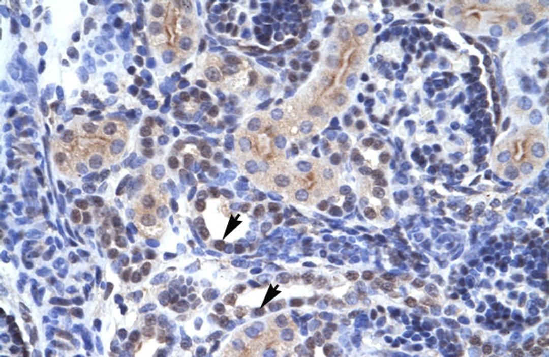 Antibody used in IHC on Human kidney.