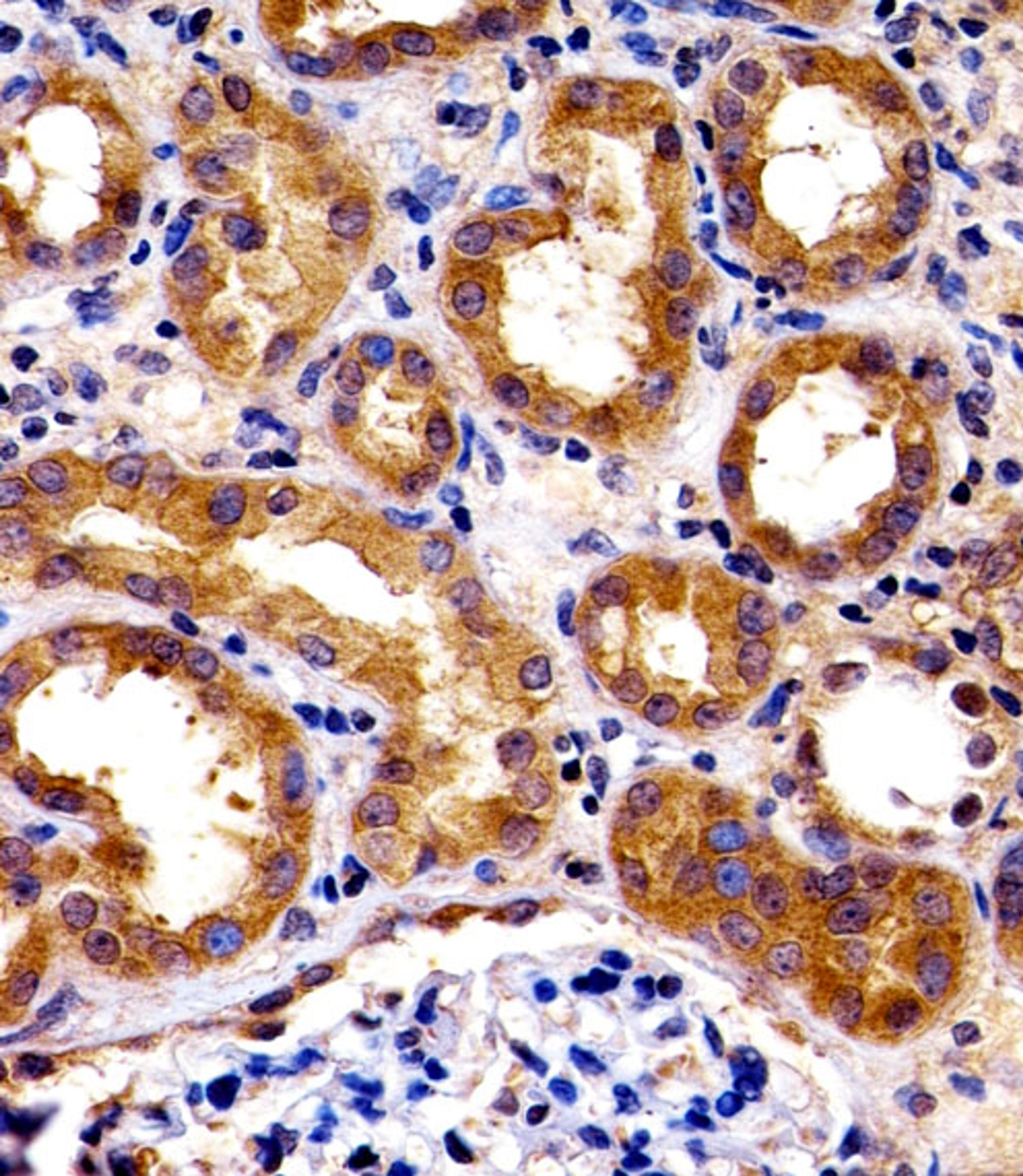 Immunohistochemical analysis of paraffin-embedded H. kidney section using SPHK1 Antibody(N-term P74) . Antibody was diluted at 1:100 dilution. A peroxidase-conjugated goat anti-rabbit IgG at 1:400 dilution was used as the secondary antibody, followed by D