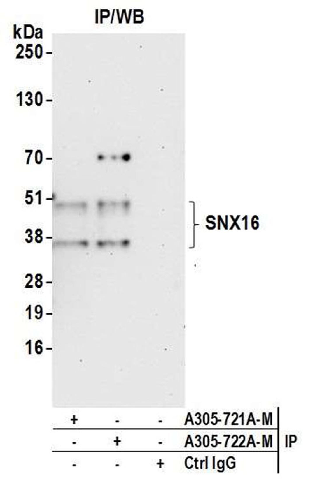 Detection of human SNX16 by WB of IP.