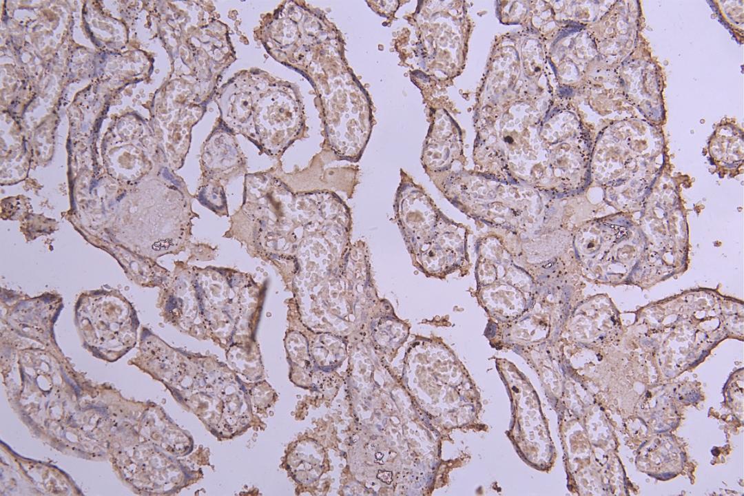 IHC image of CSB-RA007690MA1HU diluted at 1:100 and staining in paraffin-embedded human placenta tissue performed on a Leica BondTM system. After dewaxing and hydration, antigen retrieval was mediated by high pressure in a citrate buffer (pH 6.0). Section was blocked with 10% normal goat serum 30min at RT. Then primary antibody (1% BSA) was incubated at 4°C overnight. The primary is detected by a Goat anti-Human IgG labeled by HRP and visualized using 0.05% DAB.