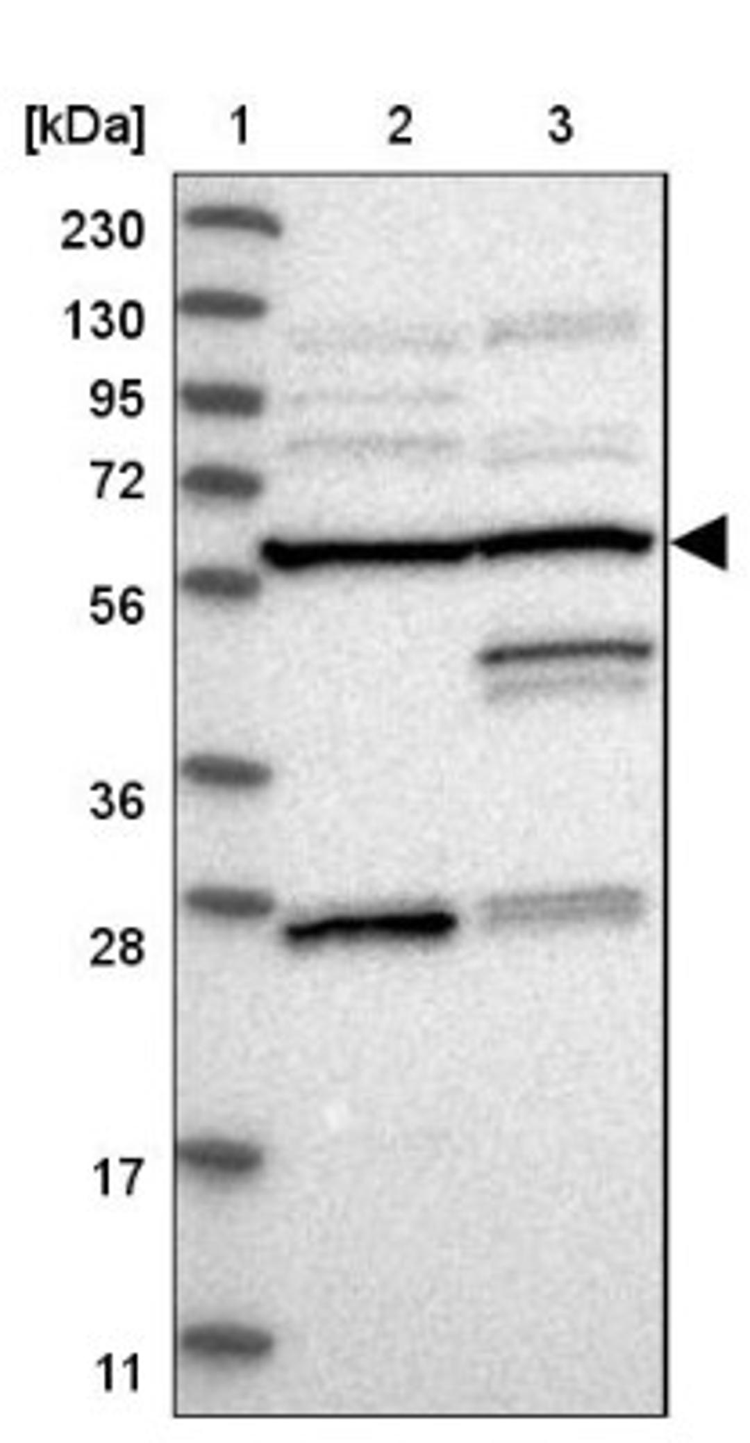 Western Blot: CNTROB Antibody [NBP1-82835] - Lane 1: Marker [kDa] 230, 130, 95, 72, 56, 36, 28, 17, 11<br/>Lane 2: Human cell line RT-4<br/>Lane 3: Human cell line U-251MG sp