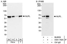 Detection of human NUPL by western blot and immunoprecipitation.