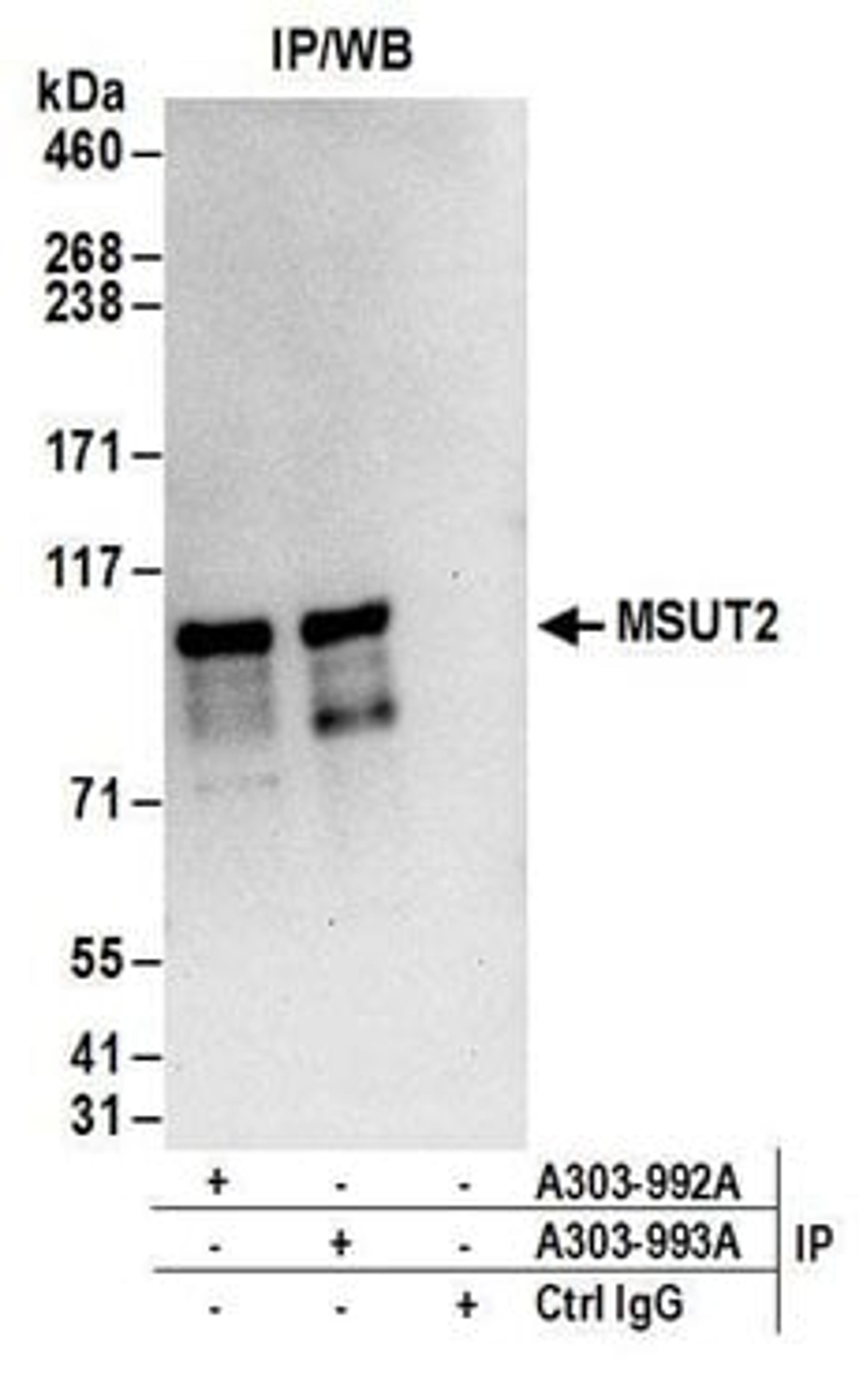 Detection of human MSUT2 by western blot of immunoprecipitates.