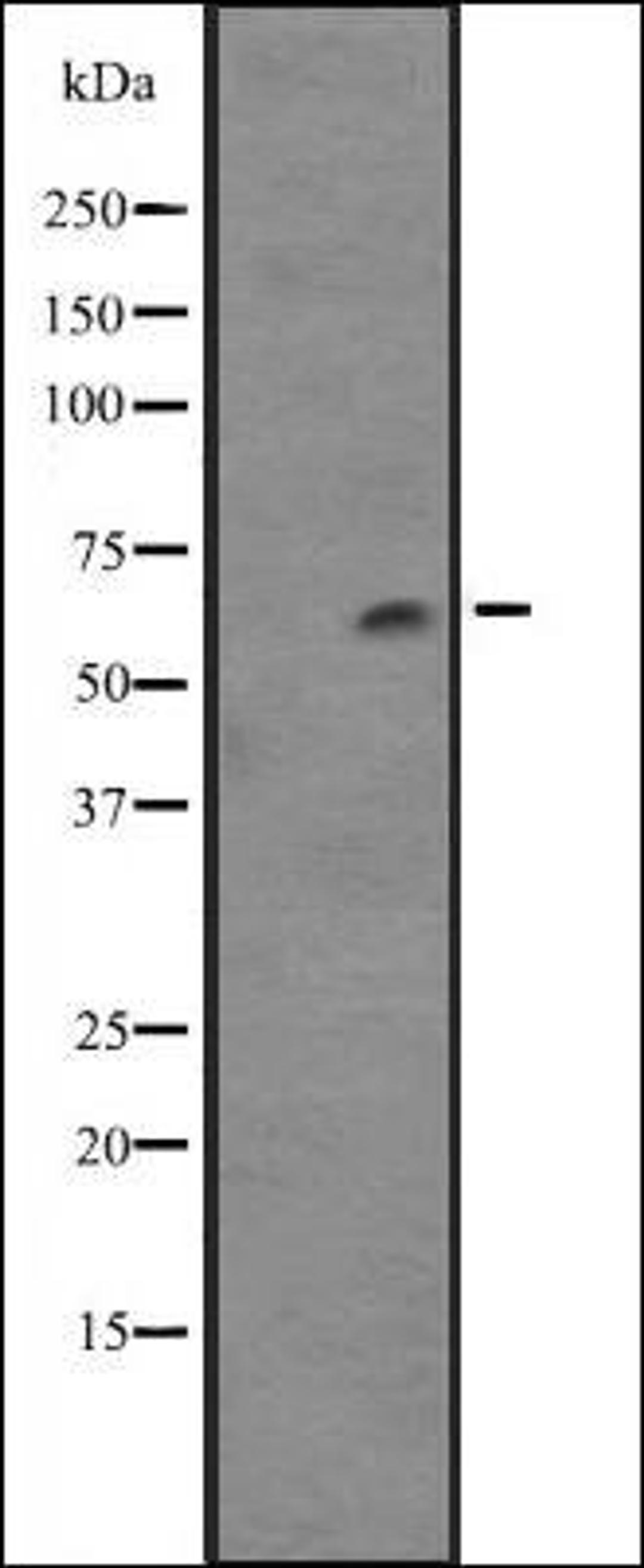 Western blot analysis of NCI-H460 cell line lysates using Cytochrome P450 4F12 antibody