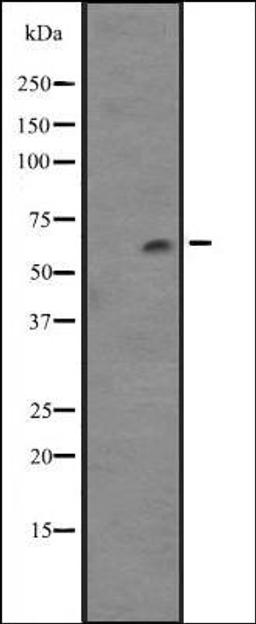 Western blot analysis of NCI-H460 cell line lysates using Cytochrome P450 4F12 antibody