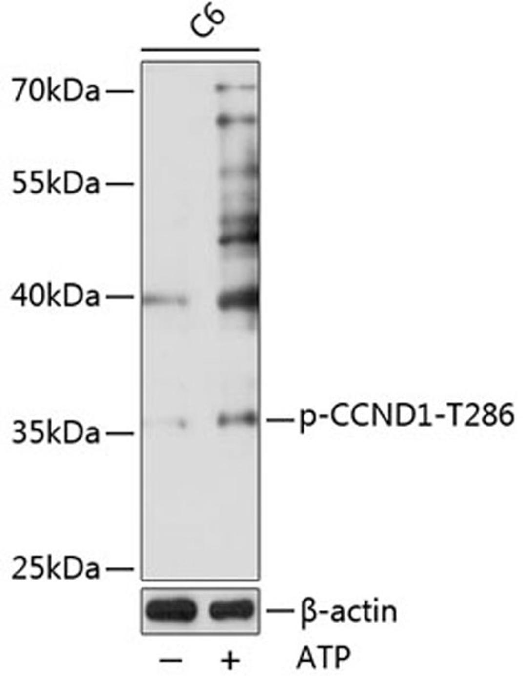 Western blot - Phospho-CCND1-T286 pAb (AP0574)