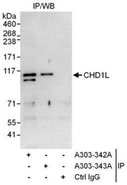 Detection of human CHD1L by western blot of immunoprecipitates.