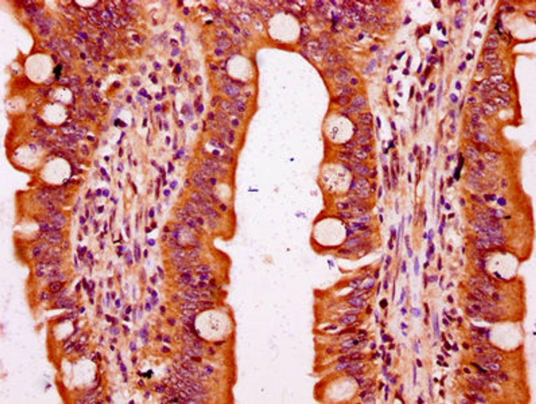 IHC image of CSB-PA731656LA01HU diluted at 1:300 and staining in paraffin-embedded human small intestine tissue performed on a Leica BondTM system. After dewaxing and hydration, antigen retrieval was mediated by high pressure in a citrate buffer (pH 6.0). Section was blocked with 10% normal goat serum 30min at RT. Then primary antibody (1% BSA) was incubated at 4°C overnight. The primary is detected by a biotinylated secondary antibody and visualized using an HRP conjugated SP system.