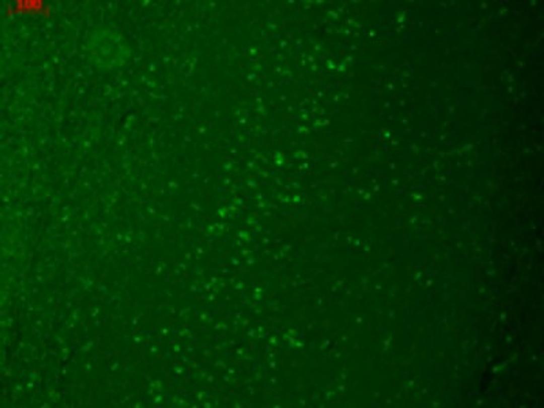 Immunocytochemistry/Immunofluorescence: TRPM7 Antibody (S74-25) [NBP2-12906] - Human hippocampal tissues.