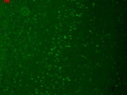 Immunocytochemistry/Immunofluorescence: TRPM7 Antibody (S74-25) [NBP2-12906] - Human hippocampal tissues.