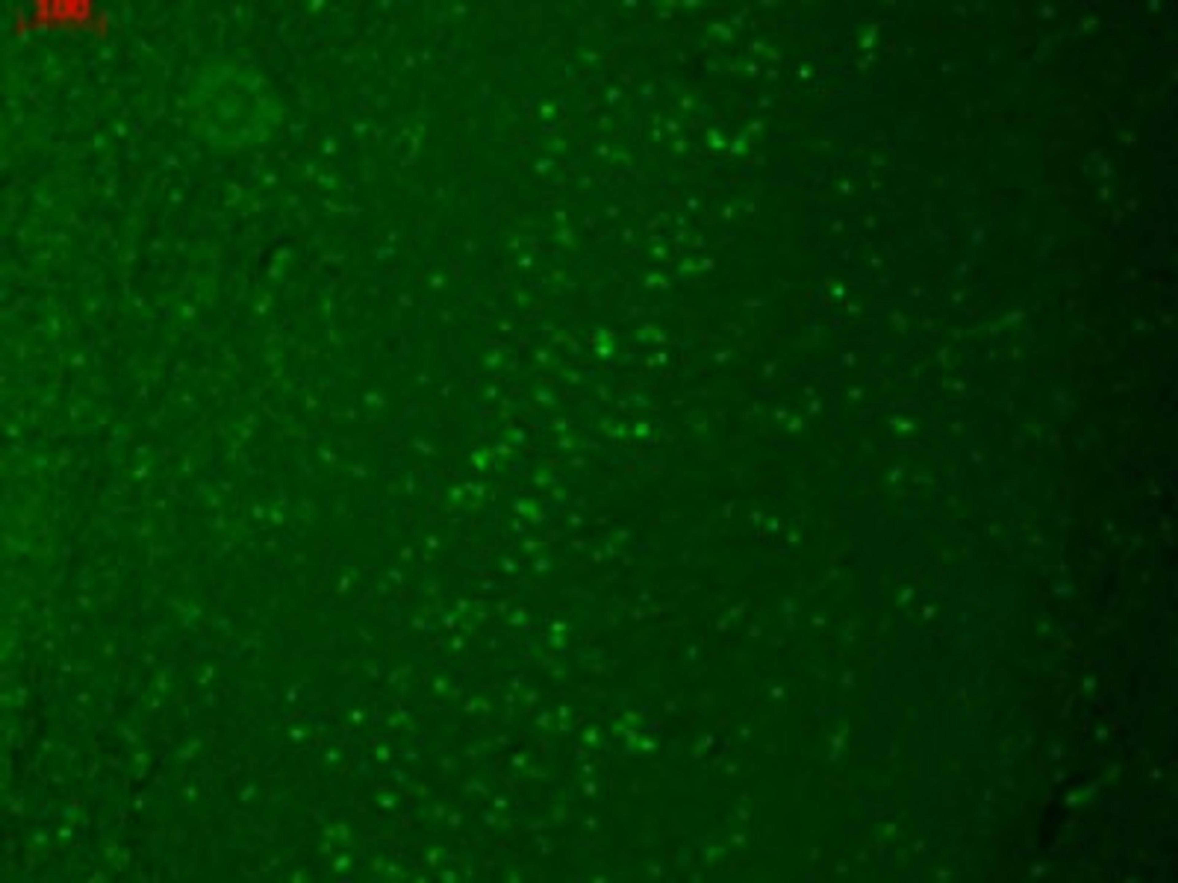 Immunocytochemistry/Immunofluorescence: TRPM7 Antibody (S74-25) [NBP2-12906] - Human hippocampal tissues.