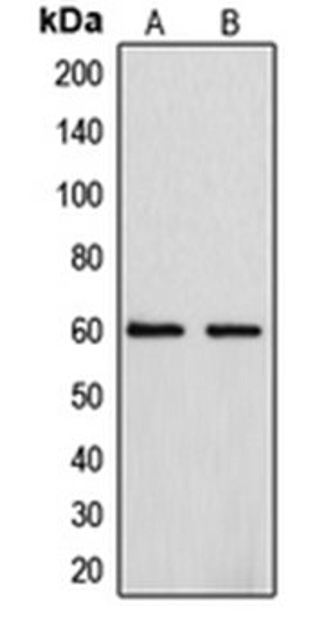 Western blot analysis of A549 (Lane 1), HepG2 (Lane 2) whole cell lysates using CYP4F2 antibody