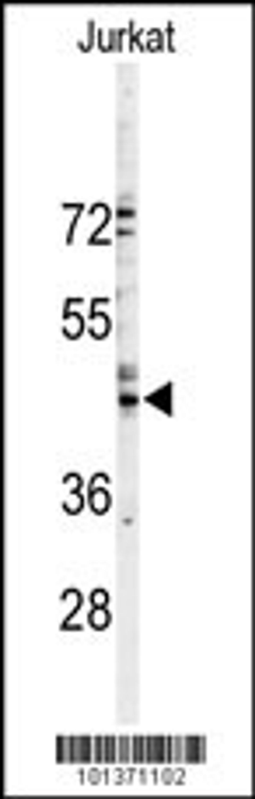 Western blot analysis of GJA3 Antibody in Jurkat cell line lysates (35ug/lane)