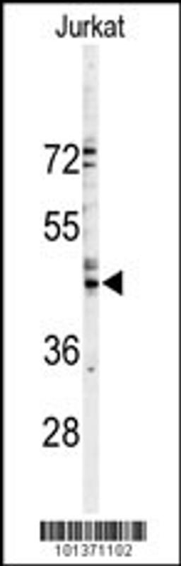 Western blot analysis of GJA3 Antibody in Jurkat cell line lysates (35ug/lane)