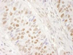 Detection of human BRG1/SMARCA4 by immunohistochemistry.