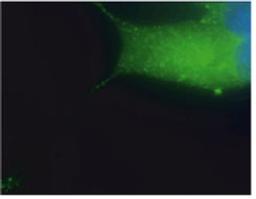 Immunocytochemistry staining of endogenous Vamp2 in AtT20cells. XW-7647 dilution: 1:200. FITC visualisation