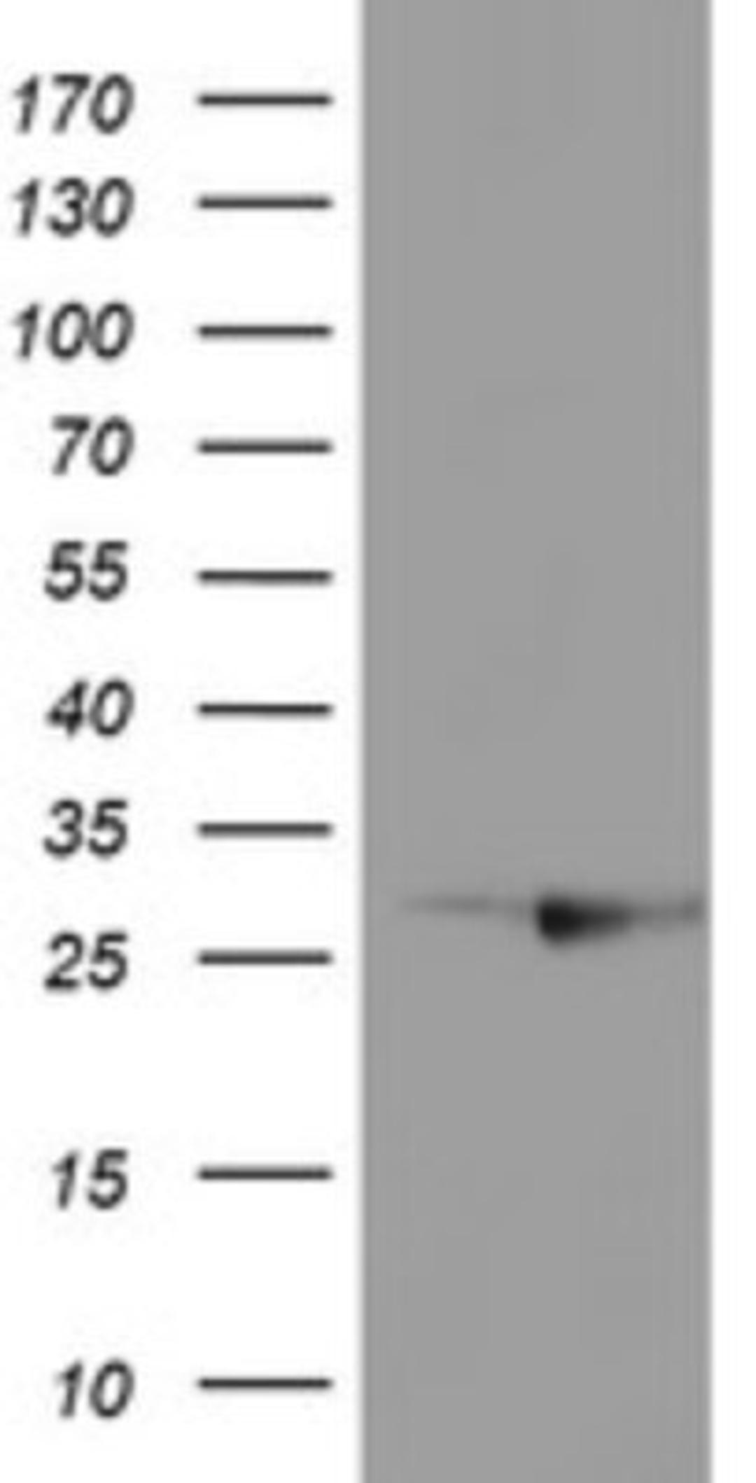 Western Blot: RABL2A Antibody (4A3) [NBP2-45513] - Analysis of HEK293T cells were transfected with the pCMV6-ENTRY control (Left lane) or pCMV6-ENTRY RABL2A.