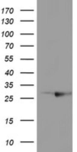 Western Blot: RABL2A Antibody (4A3) [NBP2-45513] - Analysis of HEK293T cells were transfected with the pCMV6-ENTRY control (Left lane) or pCMV6-ENTRY RABL2A.