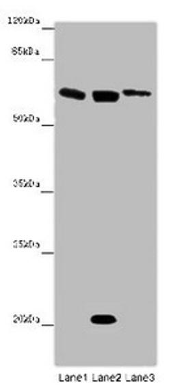 Western blot. All lanes: SRF antibody at 12 ug/ml. Lane 1: Mouse heart tissue. Lane 2: NIH/3T3 whole cell lysate. Lane 3: MCF-7 whole cell lysate. Secondary. Goat polyclonal to rabbit IgG at 1/10000 dilution. Predicted band size: 52 kDa. Observed band size: 62, 21 kDa.
