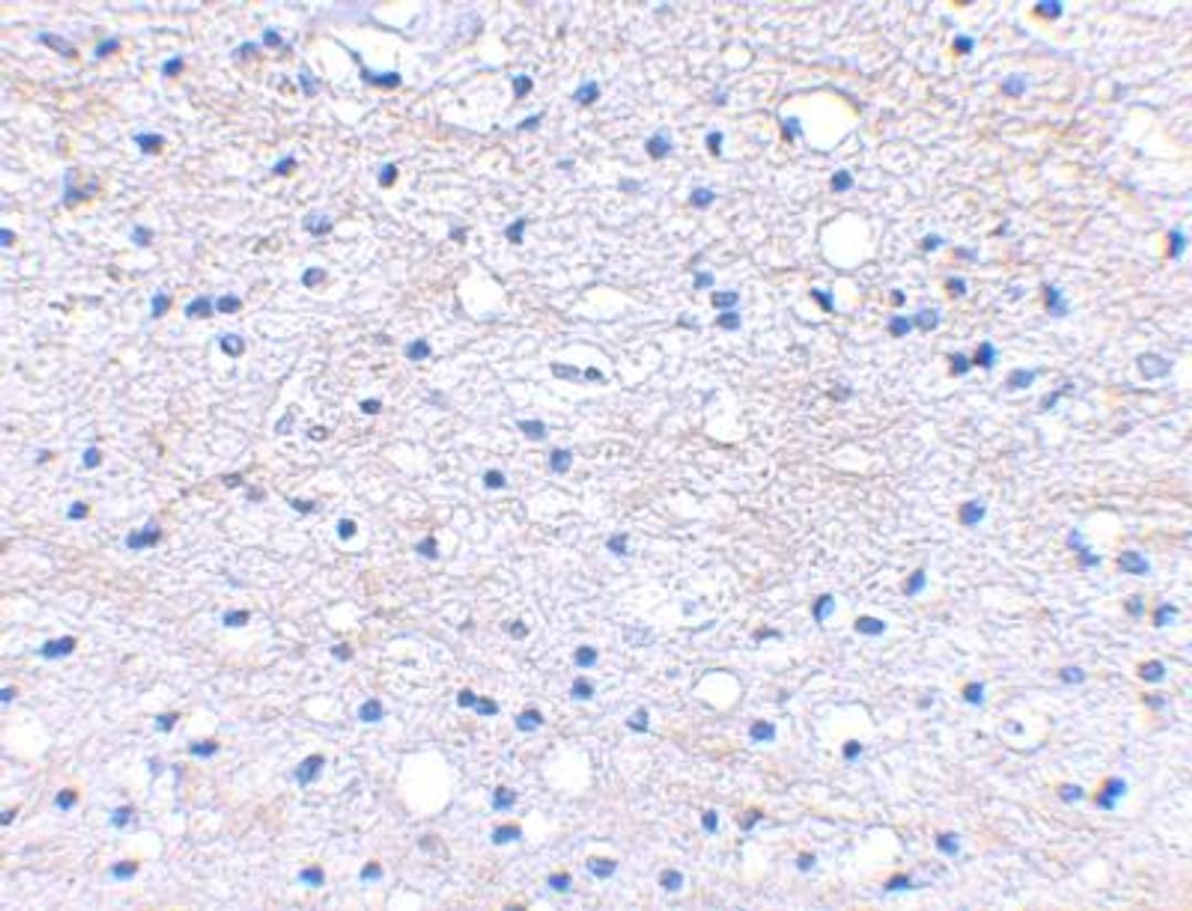 Immunohistochemistry-Paraffin: HAPLN2 Antibody [NBP1-77322] - Human brain tissue using HAPLN2 antibody at 2.5 ug/ml.