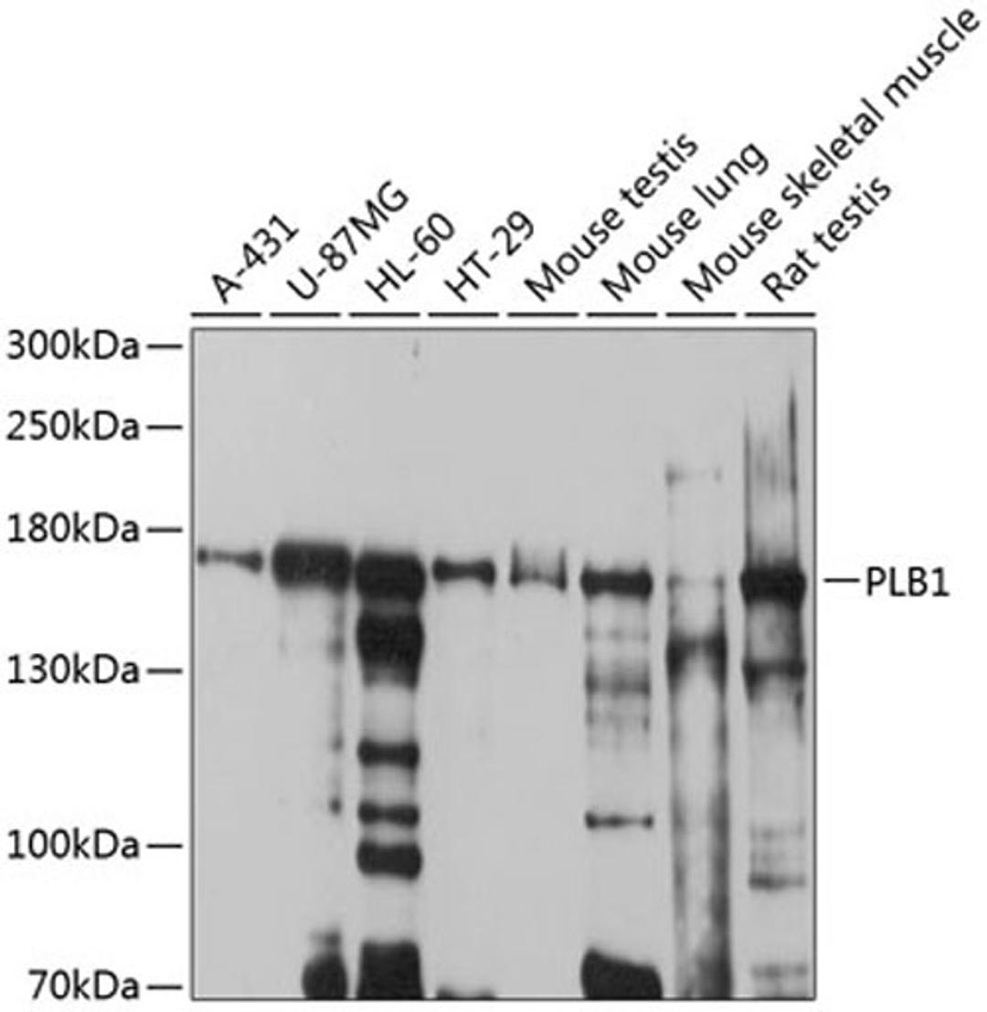 Western blot - PLB1 antibody (A10429)