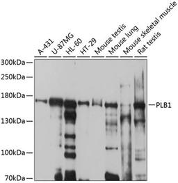 Western blot - PLB1 antibody (A10429)