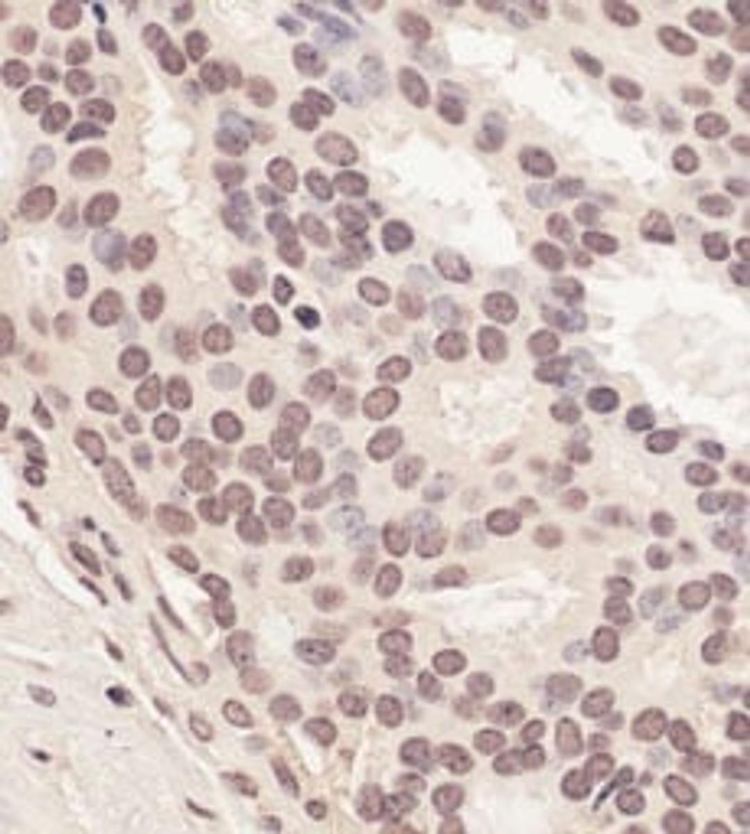 Detection of human RNF2 by immunohistochemistry.