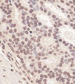 Detection of human RNF2 by immunohistochemistry.