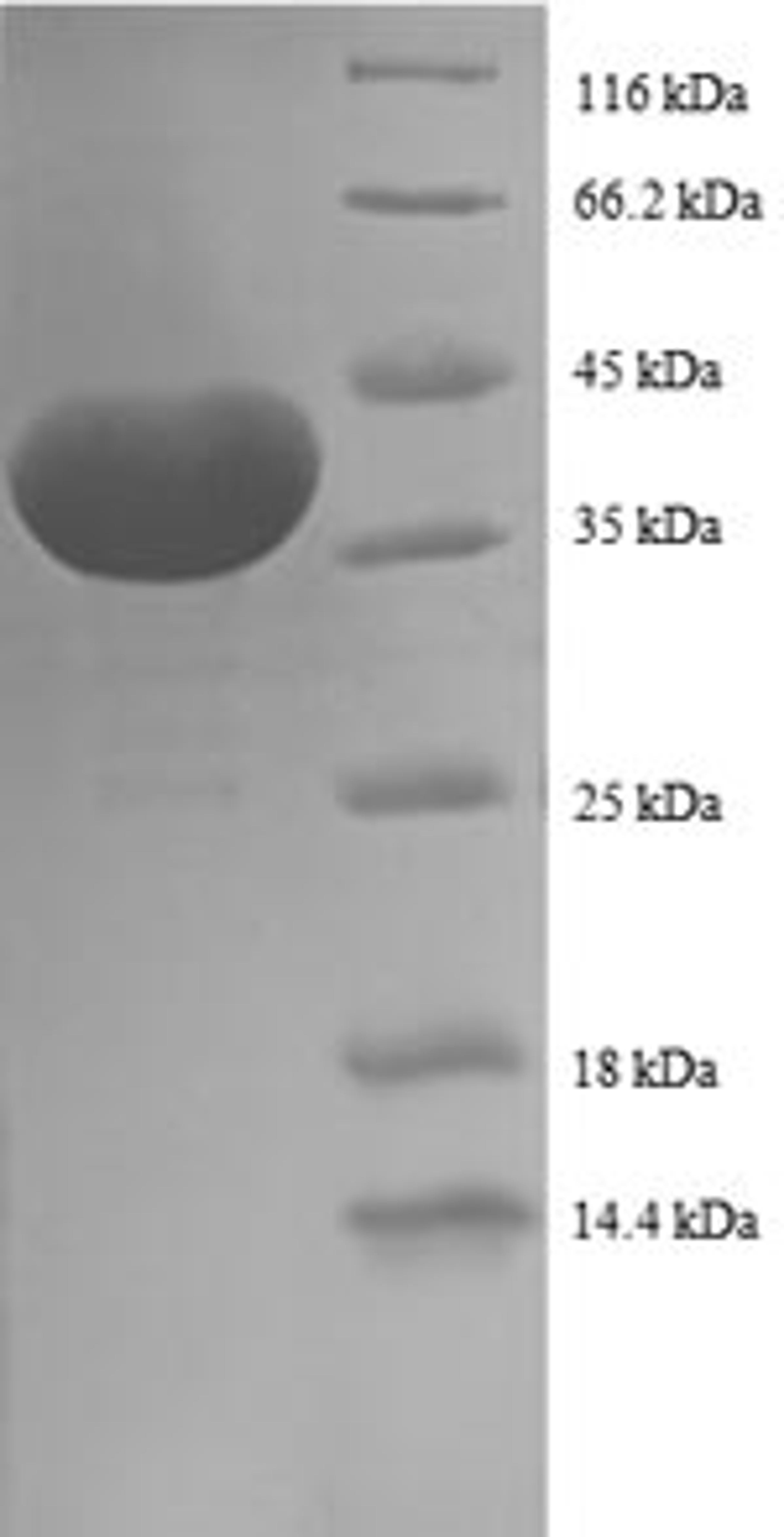 (Tris-Glycine gel) Discontinuous SDS-PAGE (reduced) with 5% enrichment gel and 15% separation gel.