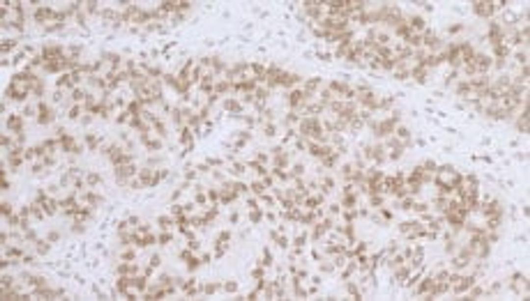 Detection of human LAP2 beta gamma /TMPO by immunohistochemistry.