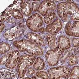 Immunohistochemistry-Paraffin: RSPRY1 Antibody [NBP1-92358] - Staining of human kidney shows strong cytoplasmic positivity in renal tubules.