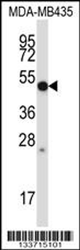 Western blot analysis in MDA-MB435 cell line lysates (35ug/lane).