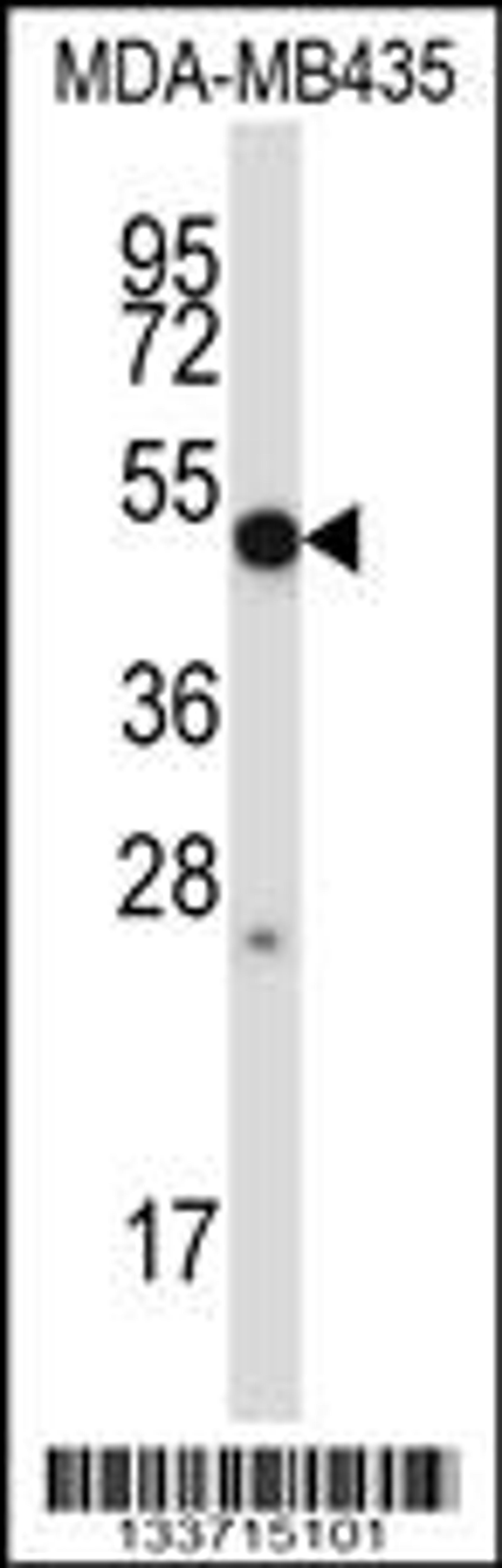 Western blot analysis in MDA-MB435 cell line lysates (35ug/lane).