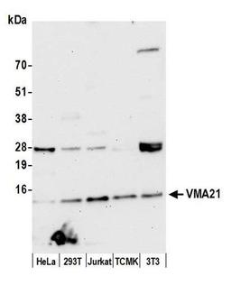 Detection of human and mouse VMA21 by WB.