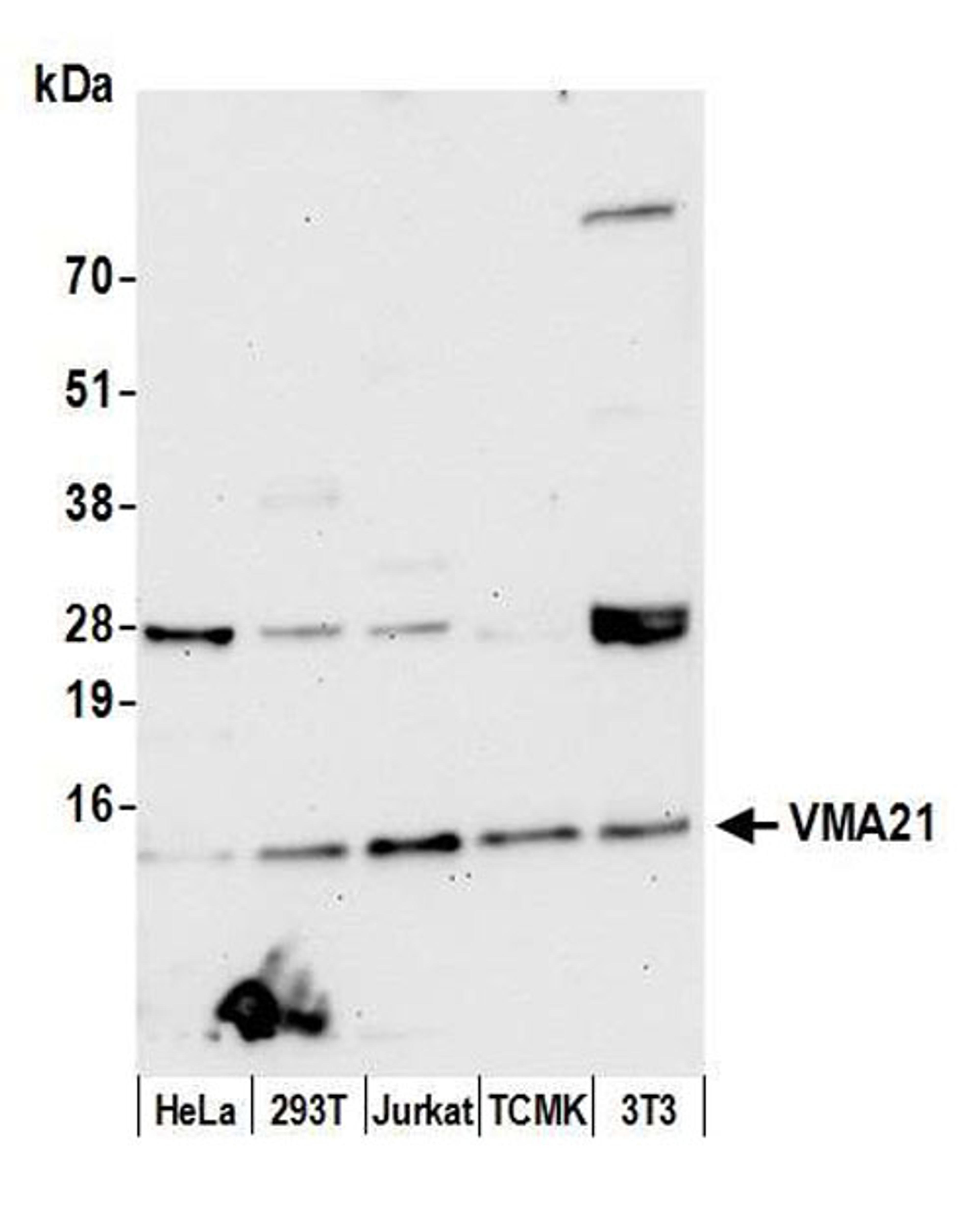 Detection of human and mouse VMA21 by WB.