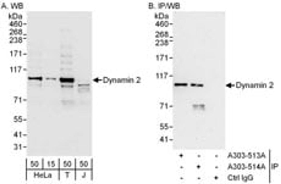 Detection of human Dynamin 2 by western blot and immunoprecipitation.