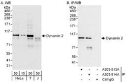 Detection of human Dynamin 2 by western blot and immunoprecipitation.