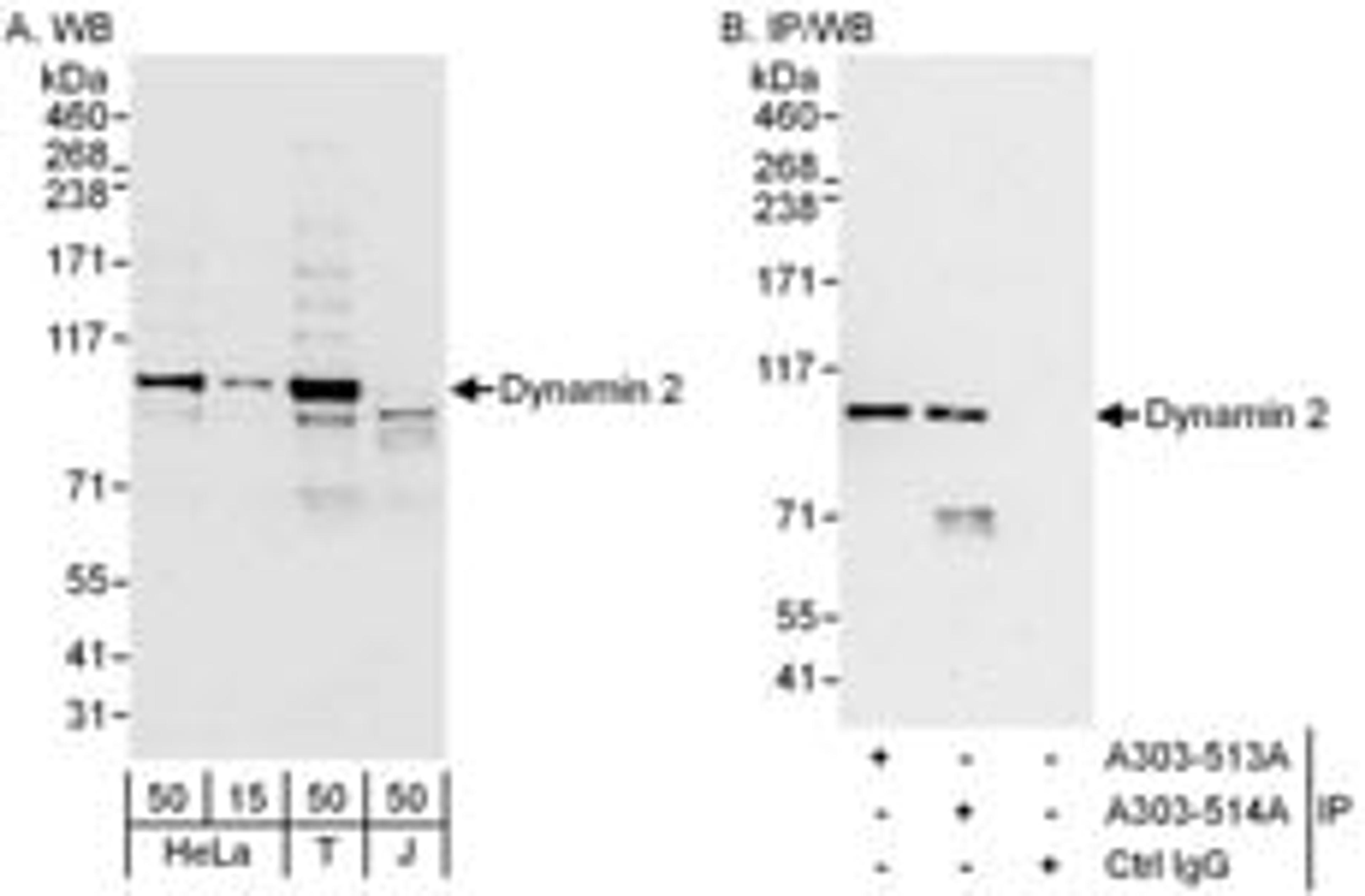 Detection of human Dynamin 2 by western blot and immunoprecipitation.