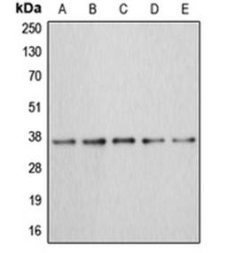 Western blot analysis of MCF7 (Lane 1), HEK293T (Lane 2), HepG2 (Lane 3), mouse kidney (Lane 4), rat liver (Lane 5) whole cell lysates using ANXA3 antibody