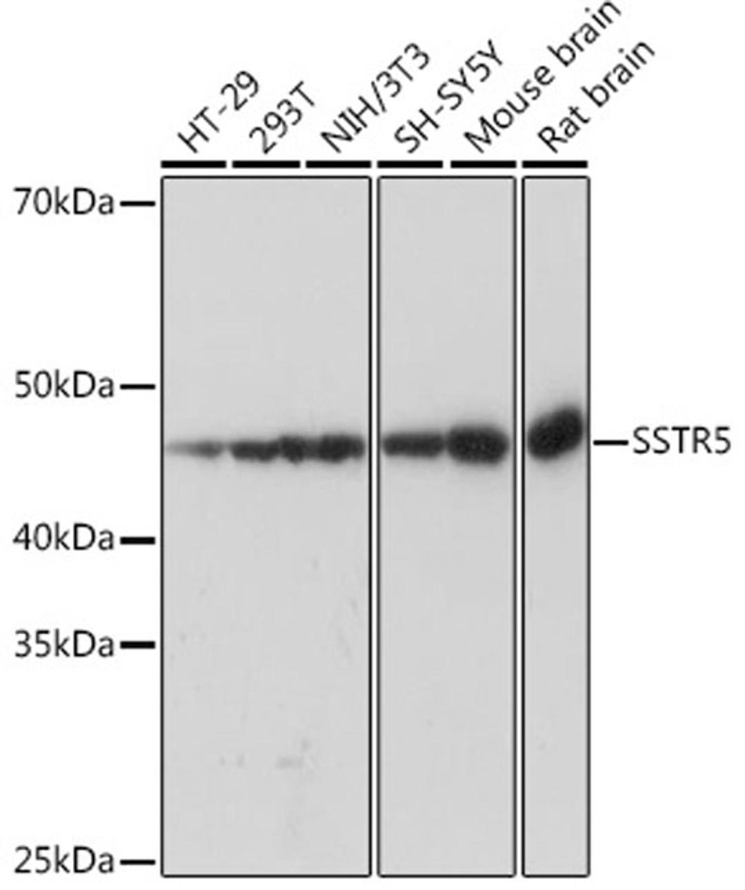 Western blot - SSTR5 Rabbit mAb (A8698)