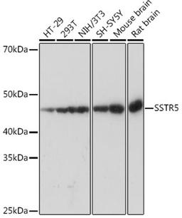 Western blot - SSTR5 Rabbit mAb (A8698)