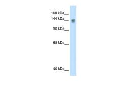 Antibody used in WB on Human Thymus at 0.2-1 ug/ml.